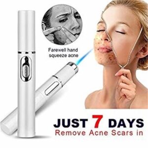 best laser treatment for acne rosacea